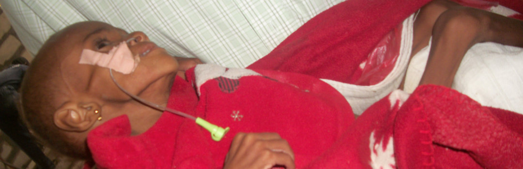 child with serious body condition
