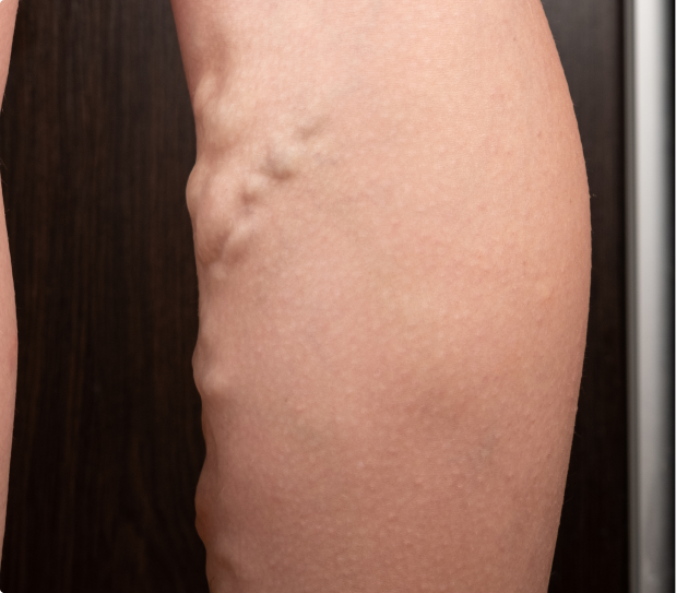 Before treatment